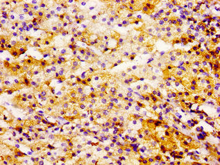 Immunohistochemistry of paraffin-embedded human adrenal gland tissue using UBE2L3 Antibody at dilution of 1:100Rabbit anti-Human UBE2L3 Polyclonal Antibody