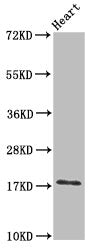 Western Blot | Positive WB detected in: Mouse heart tissue | All lanes: UBE2L3 antibody at 3μg/ml | Secondary | Goat polyclonal to rabbit IgG at 1/50000 dilution | Predicted band size: 18, 15, 25 kDa | Observed band size: 18 kDaRabbit anti-Human UBE2L3 Polyclonal Antibody