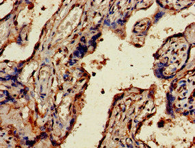 Immunohistochemistry of paraffin-embedded human placenta tissue using UBE2V2 Antibody at dilution of 1:100Rabbit anti-Human UBE2V2 Polyclonal Antibody