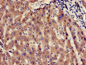 Immunohistochemistry of paraffin-embedded human liver tissue using UBE2V2 Antibody at dilution of 1:100Rabbit anti-Human UBE2V2 Polyclonal Antibody