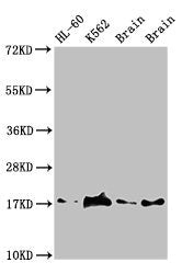 Western Blot  | Positive WB detected in: HL60 whole cell lysate, K562 whole cell lyaste, Mouse brain tissue, Rat brain tissue  | All lanes: UBE2V2 antibody at 1.5µg/ml  | Secondary  | Goat polyclonal to rabbit IgG at 1/50000 dilution  | Predicted band size: 17 kDa  | Observed band size: 17 kDaRabbit anti-Human UBE2V2 Polyclonal Antibody