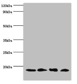 Western blot  | All lanes: UBE2V2 antibody at 3µg/ml  | Lane 1: Hela whole cell lysate  | Lane 2: Mouse brain tissue  | Lane 3: Jurkat whole cell lysate  | Lane 4: K562 whole cell lysate  | Secondary  | Goat polyclonal to rabbit IgG at 1/10000 dilution  | Predicted band size: 16 kDa  | Observed band size: 16 kDaRabbit anti-Human UBE2V2 Polyclonal Antibody