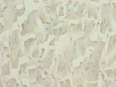 Immunohistochemistry of paraffin-embedded human heart tissue using UCP3 Antibody at dilution of 1:100Rabbit anti-Human UCP3 Polyclonal Antibody