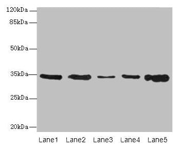 Western blot  | All lanes: UCP3 antibody at 0.9µg/ml  | Lane 1: Jurkat whole cell lysate  | Lane 2: SH-SY5Y whole cell lysate  | Lane 3: U251 whole cell lysate  | Lane 4: A549 whole cell lysate  | Lane 5: Hela whole cell lysate  | Secondary  | Goat polyclonal to rabbit IgG at 1/10000 dilution  | Predicted band size: 35, 30, 23 kDa  | Observed band size: 35 kDaRabbit anti-Human UCP3 Polyclonal Antibody