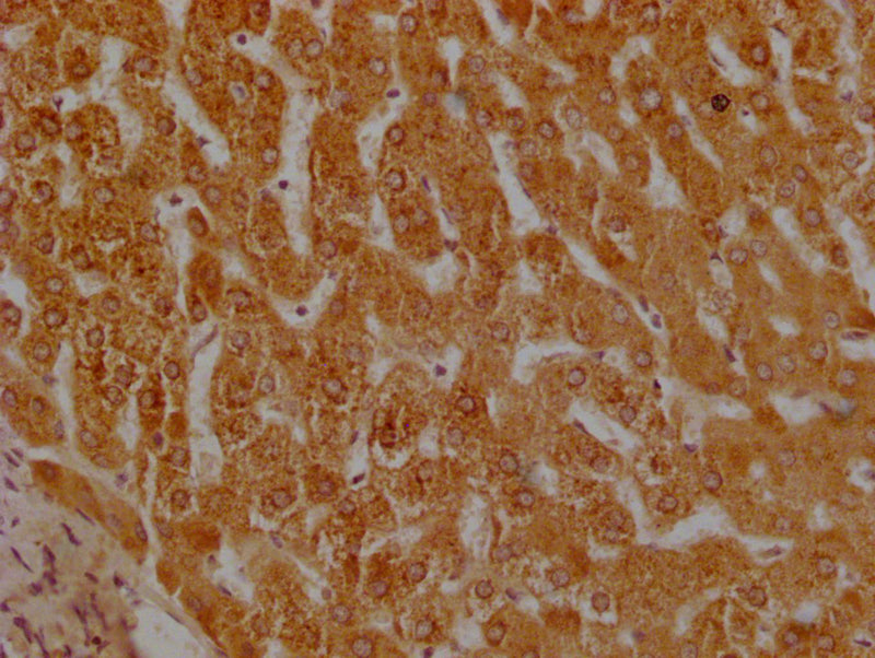IHC image of UGT1A1 Antibody diluted at 1:200 and staining in paraffin-embedded human liver tissue performed on a Leica BondTM system. After dewaxing and hydration, antigen retrieval was mediated by high pressure in a citrate buffer (pH 6.0). Section was blocked with 10% normal goat serum 30min at RT. Then primary antibody (1% BSA) was incubated at 4°C overnight. The primary is detected by a Goat anti-rabbit polymer IgG labeled by HRP and visualized using 0.05% DAB.Rabbit anti-Human UGT1A1 Polyclonal Antibody