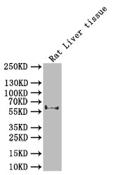 Western BlotPositive WB detected in: Rat Liver tissue lysate All lanes: UGT1A1 antibody at 1:1000SecondaryGoat polyclonal to rabbit IgG at 1/50000 dilutionPredicted band size: 60 kDaObserved band size: 60 kDaRabbit anti-Human UGT1A1 Polyclonal Antibody
