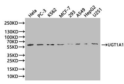Western BlotPositive WB detected in: SH-SY5Y whole cell lysate, LO2 whole cell lysate, 293T whole cell lysate, HL-60 whole cell lysateAll lanes: UGT1A1 antibody at 1:2000SecondaryGoat polyclonal to rabbit IgG at 1/50000 dilutionPredicted band size: 60, 50 kDaObserved band size: 60 kDaRabbit anti-Human UGT1A1 Polyclonal Antibody