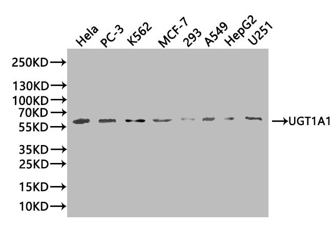 Western BlotPositive WB detected in: SH-SY5Y whole cell lysate, LO2 whole cell lysate, 293T whole cell lysate, HL-60 whole cell lysateAll lanes: UGT1A1 antibody at 1:2000SecondaryGoat polyclonal to rabbit IgG at 1/50000 dilutionPredicted band size: 60, 50 kDaObserved band size: 60 kDaRabbit anti-Human UGT1A1 Polyclonal Antibody