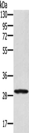 Gel: 8%SDS-PAGE, Lysate: 40 μg, Lane: 293T cells, Primary antibody: EDA2R Antibody(EDA2R Antibody) at dilution 1/250, Secondary antibody: Goat anti rabbit IgG at 1/8000 dilution, Exposure time: 10 secondsRabbit anti-Human EDA2R Polyclonal Antibody