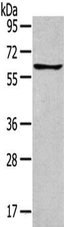 Gel: 8%SDS-PAGE,Lysate: 40 μg,,Primary antibody: GLP2R Antibody(GLP2R Antibody) at dilution 1/400 dilution,Secondary antibody: Goat anti rabbit IgG at 1/8000 dilution,Exposure time: 1 minuteRabbit anti-Human GLP2R Polyclonal Antibody