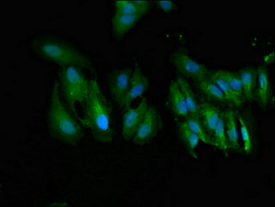 Immunofluorescent analysis of Hela cells using UGT1A9 Antibody at dilution of 1:100 and Alexa Fluor 488-congugated AffiniPure Goat Anti-Rabbit IgG(H+L)