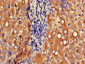 Immunohistochemistry of paraffin-embedded human liver tissue using UGT1A9 Antibody at dilution of 1:100