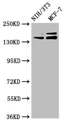 Western Blot  | Positive WB detected in: NIH/3T3 whole cell lysate, MCF-7 whole cell lysate  | All lanes: UMODL1 antibody at 5.1µg/ml  | Secondary  | Goat polyclonal to rabbit IgG at 1/50000 dilution  | Predicted band size: 145, 157, 137, 150 kDa  | Observed band size: 145, 157 kDaRabbit anti-Human UMODL1 Polyclonal Antibody