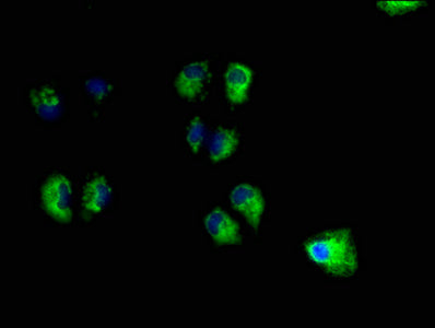 Immunofluorescence staining of Hela cells with UNC13B Antibody at 1:100, counter-stained with DAPI. The cells were fixed in 4% formaldehyde, permeabilized using 0.2% Triton X-100 and blocked in 10% normal Goat Serum. The cells were then incubated with the antibody overnight at 4°C. The secondary antibody was Alexa Fluor 488-congugated AffiniPure Goat Anti-Rabbit IgG(H+L).Rabbit anti-Human UNC13B Polyclonal Antibody