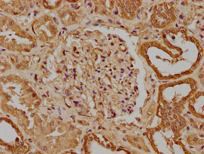 IHC image of the antibody diluted at 1:300 and staining in paraffin-embedded human kidney tissue performed on a Leica BondTM system. After dewaxing and hydration, antigen retrieval was mediated by high pressure in a citrate buffer (pH 6.0). Section was blocked with 10% normal goat serum 30min at RT. Then primary antibody (1% BSA) was incubated at 4°C overnight. The primary is detected by a biotinylated secondary antibody and visualized using an HRP conjugated SP system.Rabbit anti-Human UNC13B Polyclonal Antibody