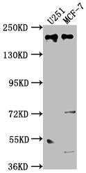 Western Blot | Positive WB detected in: U251 whole cell lysate, MCF-7 whole cell lysate | All lanes: UNC13B antibody at 1:2000 | Secondary | Goat polyclonal to rabbit IgG at 1/50000 dilution | Predicted band size: 181, 183 kDa | Observed band size: 181 kDaRabbit anti-Human UNC13B Polyclonal Antibody