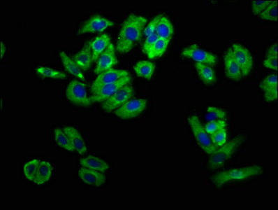 Immunofluorescence staining of HepG2 cells with UNC5B Antibody at 1:100, counter-stained with DAPI. The cells were fixed in 4% formaldehyde, permeabilized using 0.2% Triton X-100 and blocked in 10% normal Goat Serum. The cells were then incubated with the antibody overnight at 4°C. The secondary antibody was Alexa Fluor 488-congugated AffiniPure Goat Anti-Rabbit IgG(H+L).Rabbit anti-Human UNC5B Polyclonal Antibody