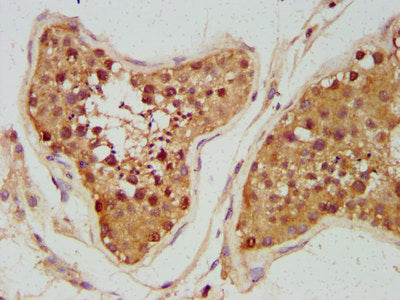 IHC image of UNC5B Antibody diluted at 1:300 and staining in paraffin-embedded human testis tissue performed on a Leica BondTM system. After dewaxing and hydration, antigen retrieval was mediated by high pressure in a citrate buffer (pH 6.0). Section was blocked with 10% normal goat serum 30min at RT. Then primary antibody (1% BSA) was incubated at 4°C overnight. The primary is detected by a biotinylated secondary antibody and visualized using an HRP conjugated SP system.Rabbit anti-Human UNC5B Polyclonal Antibody