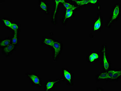 Immunofluorescent analysis of Hela cells using UNG Antibody at dilution of 1:100 and Alexa Fluor 488-congugated AffiniPure Goat Anti-Rabbit IgG(H+L)Rabbit anti-Human UNG Polyclonal Antibody
