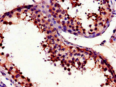 Immunohistochemistry of paraffin-embedded human testis tissue using the antibody at dilution of 1:100Rabbit anti-Human UNG Polyclonal Antibody
