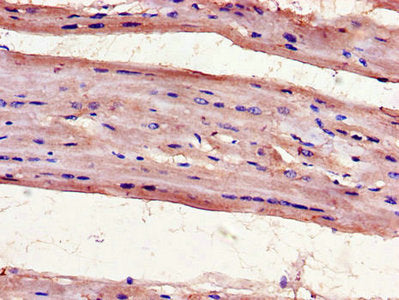 Immunohistochemistry of paraffin-embedded human heart tissue using UNG Antibody at dilution of 1:100Rabbit anti-Human UNG Polyclonal Antibody