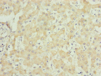 Immunohistochemistry of paraffin-embedded human liver tissue using UQCRC1 Antibody at dilution of 1:100Rabbit anti-Human UQCRC1 Polyclonal Antibody
