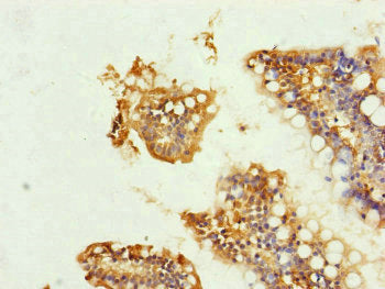 Immunohistochemistry of paraffin-embedded human small intestine tissue using UQCRC1 Antibody at dilution of 1:100Rabbit anti-Human UQCRC1 Polyclonal Antibody