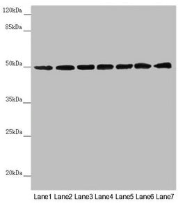 Western blot  | All lanes: UQCRC1 antibody at 2.5µg/ml  | Lane 1: Mouse large intestine tissue  | Lane 2: Mouse kidney tissue  | Lane 3: Mouse brain tissue  | Lane 4: LO2 whole cell lysate  | Lane 5: Hela whole cell lysate  | Lane 6: HepG2 whole cell lysate  | Lane 7: MCF-7 whole cell lysate  | Secondary  | Goat polyclonal to rabbit IgG at 1/10000 dilution  | Predicted band size: 53 kDa  | Observed band size: 53 kDaRabbit anti-Human UQCRC1 Polyclonal Antibody