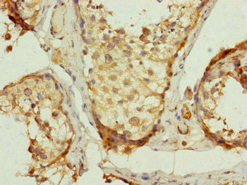Immunohistochemistry of paraffin-embedded human testis tissue using UQCRC2 Antibody at dilution of 1:100Rabbit anti-Human UQCRC2 Polyclonal Antibody