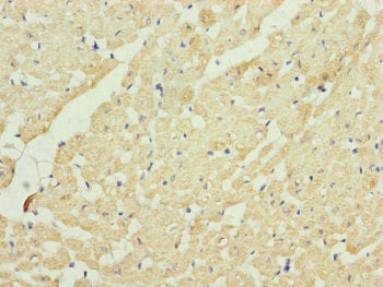 Immunohistochemistry of paraffin-embedded human heart tissue using UQCRC2 Antibody at dilution of 1:100Rabbit anti-Human UQCRC2 Polyclonal Antibody