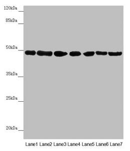 Western blot  | All lanes: UQCRC2 antibody at 2.95µg/ml  | Lane 1: Human placenta tissue  | Lane 2: Mouse large intestine tissue  | Lane 3: Mouse small intestine tissue  | Lane 4: Mouse brain tissue  | Lane 5: HepG2 whole cell lysate  | Lane 6: Jurkat whole cell lysate  | Lane 7: 293T whole cell lysate  | Secondary  | Goat polyclonal to rabbit IgG at 1/10000 dilution  | Predicted band size: 48 kDa  | Observed band size: 48 kDaRabbit anti-Human UQCRC2 Polyclonal Antibody