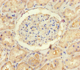Immunohistochemistry of paraffin-embedded human kidney tissue using USP14 Antibody at dilution of 1:100Rabbit anti-Human USP14 Polyclonal Antibody