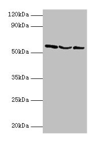 Western blot  | All lanes: USP14 antibody at 2µg/ml  | Lane 1: Hela whole cell lysate  | Lane 2: 293T whole cell lysate  | Lane 3: NIH/3T3 whole cell lysate  | Secondary  | Goat polyclonal to rabbit IgG at 1/10000 dilution  | Predicted band size: 57, 53, 55 kDa  | Observed band size: 57 kDaRabbit anti-Human USP14 Polyclonal Antibody