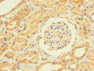 Immunohistochemistry of paraffin-embedded human kidney tissue using USP5 Antibody at dilution of 1:100Rabbit anti-Human USP5 Polyclonal Antibody