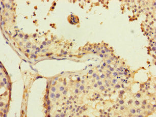 Immunohistochemistry of paraffin-embedded human testis tissue using USP5 Antibody at dilution of 1:100Rabbit anti-Human USP5 Polyclonal Antibody