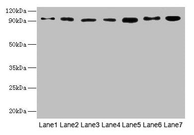Western blot  | All lanes: USP5 antibody at 10µg/ml  | Lane 1: Mouse brain tissue  | Lane 2: A549 whole cell lysate  | Lane 3: MCF-7 whole cell lysate  | Lane 4: A375 whole cell lysate  | Lane 5: U251 whole cell lysate  | Secondary  | Goat polyclonal to rabbit IgG at 1/10000 dilution  | Predicted band size: 96, 94 kDa  | Observed band size: 96 kDaRabbit anti-Human USP5 Polyclonal Antibody