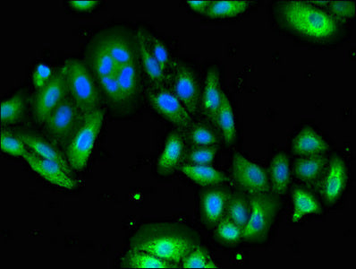 Immunofluorescent analysis of HepG2 cells using USP6 Antibody at dilution of 1:100 and Alexa Fluor 488-congugated AffiniPure Goat Anti-Rabbit IgG(H+L)Rabbit anti-Human USP6 Polyclonal Antibody
