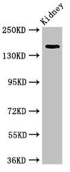 Western Blot | Positive WB detected in: Rat kidney tissue | All lanes: USP6 antibody at 4μg/ml | Secondary | Goat polyclonal to rabbit IgG at 1/50000 dilution | Predicted band size: 159, 122, 90 kDa | Observed band size: 159 kDaRabbit anti-Human USP6 Polyclonal Antibody