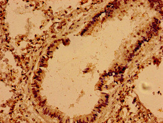 Immunohistochemistry of paraffin-embedded human lung tissue using VAMP7 Antibody at dilution of 1:100Rabbit anti-Human VAMP7 Polyclonal Antibody