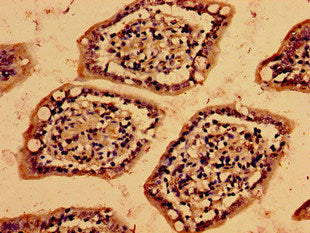 Immunohistochemistry of paraffin-embedded human small intestine tissue using VAMP7 Antibody at dilution of 1:100Rabbit anti-Human VAMP7 Polyclonal Antibody