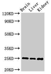 Western Blot  | Positive WB detected in: Mouse brain tissue, Mouse liver tissue, Mouse kidney tissue  | All lanes: VAMP7 antibody at 2µg/ml  | Secondary  | Goat polyclonal to rabbit IgG at 1/50000 dilution  | Predicted band size: 25, 31, 21 kDa  | Observed band size: 25 kDaRabbit anti-Human VAMP7 Polyclonal Antibody