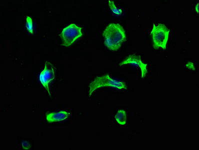 Immunofluorescence staining of MCF-7 cells with VASN Antibody at 1:213, counter-stained with DAPI. The cells were fixed in 4% formaldehyde, permeabilized using 0.2% Triton X-100 and blocked in 10% normal Goat Serum. The cells were then incubated with the antibody overnight at 4°C. The secondary antibody was Alexa Fluor 488-congugated AffiniPure Goat Anti-Rabbit IgG(H+L).Rabbit anti-Human VASN Polyclonal Antibody