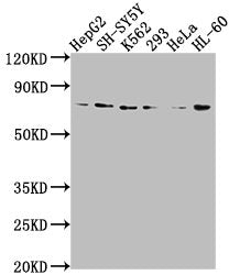 Western Blot  | Positive WB detected in: HepG2 whole cell lysate, SH-SY5Y whole cell lysate, K562 whole cell lysate, 293 whole cell lysate, Hela whole cell lysate, HL60 whole cell lysate  | All lanes: VASN antibody at 1:2000  | Secondary  | Goat polyclonal to rabbit IgG at 1/50000 dilution  | Predicted band size: 72 kDa  | Observed band size: 72 kDaRabbit anti-Human VASN Polyclonal Antibody