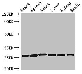Western Blot  | Positive WB detected in: Rat heart tissue, Rat spleen tissue, Mouse heart tissue, Mouse liver tissue, Mouse kidney tissue, Mouse brain tissue  | All lanes: VEGFB antibody at 3.5μg/ml  | Secondary  | Goat polyclonal to rabbit IgG at 1/50000 dilution  | Predicted band size: 22 kDa  | Observed band size: 28 kDaRabbit anti-Human VEGFB Polyclonal Antibody