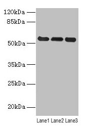 Western blot  | All lanes: VIM antibody at 8µg/ml  | Lane 1: Hela whole cell lysate  | Lane 2: Jurkat whole cell lysate  | Lane 3: A549 whole cell lysate  | Secondary  | Goat polyclonal to rabbit IgG at 1/10000 dilution  | Predicted band size: 54 kDa  | Observed band size: 54 kDaRabbit anti-Human VIM Polyclonal Antibody