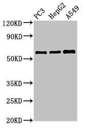 Western Blot | Positive WB detected in: PC-3 whole cell lysate, HepG2 whole cell lysate, A549 whole cell lysate | All lanes: vnn1 antibody at 3.4μg/ml | Secondary | Goat polyclonal to rabbit IgG at 1/50000 dilution | Predicted band size: 58 kDa | Observed band size: 58 kDaRabbit anti-Human VNN1 Polyclonal Antibody