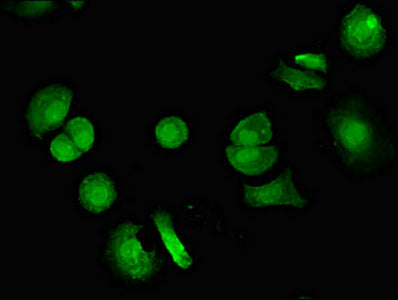 Immunofluorescent analysis of MCF-7 cells using VPS4B Antibody at dilution of 1:100 and Alexa Fluor 488-congugated AffiniPure Goat Anti-Rabbit IgG(H+L)Rabbit anti-Human VPS4B Polyclonal Antibody