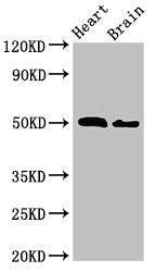 Western Blot | Positive WB detected in: Mouse heart tissue, Mouse brain tissue | All lanes: VPS4B antibody at 2.5μg/ml | Secondary | Goat polyclonal to rabbit IgG at 1/50000 dilution | Predicted band size: 50 kDa | Observed band size: 50 kDaRabbit anti-Human VPS4B Polyclonal Antibody