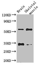 Western BlotPositive WB detected in: Mouse brain tissue, Mouse skeletal muscle tissueAll lanes: VTN antibody at 1:700SecondaryGoat polyclonal to rabbit IgG at 1/50000 dilutionPredicted band size: 55 kDaObserved band size: 55, 34 kDaRabbit anti-Human VTN Polyclonal Antibody