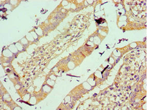 Immunohistochemistry of paraffin-embedded human small intestine tissue using VTN Antibody at dilution of 1:100Rabbit anti-Human VTN Polyclonal Antibody